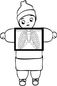 x-ray-310167_640